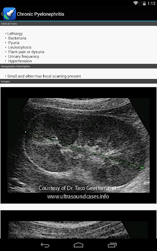 Ultrasound by iSonographer