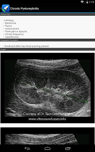 How to get Ultrasound by iSonographer lastet apk for android