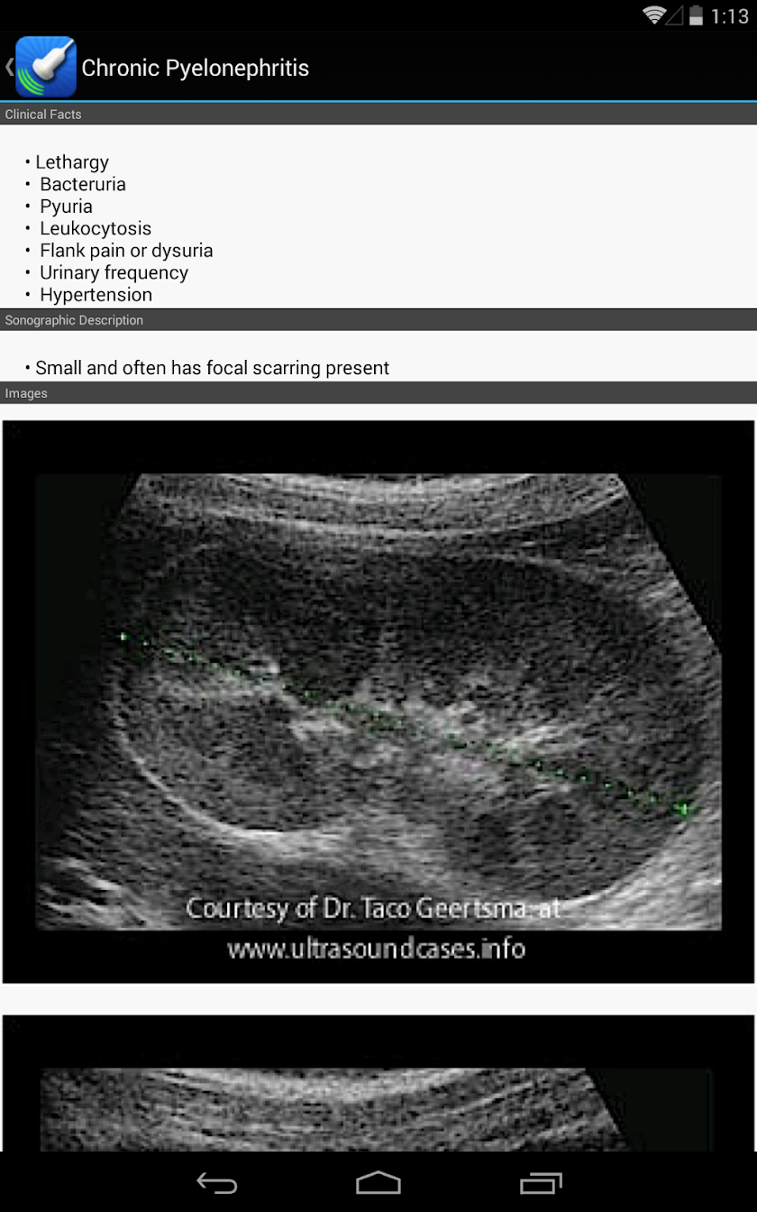 Ultrasound by iSonographer Screen 1