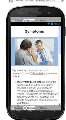 Ehlers Danlos Syndrome Diseaseのおすすめ画像3