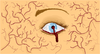 Eyeseeblood