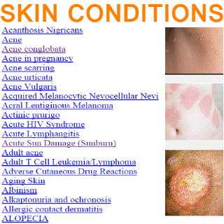 Skin Conditions Facts