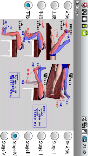 【免費醫療App】ブルンストロームステージ（片麻痺機能検査）-APP點子