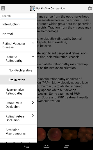 免費下載醫療APP|OphthoSim Companion app開箱文|APP開箱王