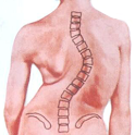 Korea University Scoliosis logo