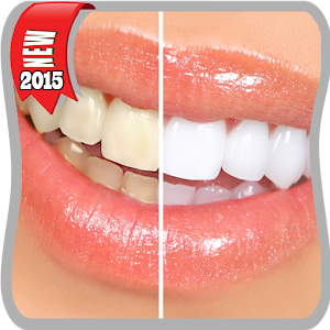 وصفات جديدة لتبييض الاسنان 2.0