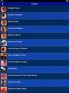 Endoscopia HCFMUSP