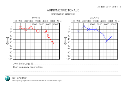  Test d'Audition – Vignette de la capture d'écran  