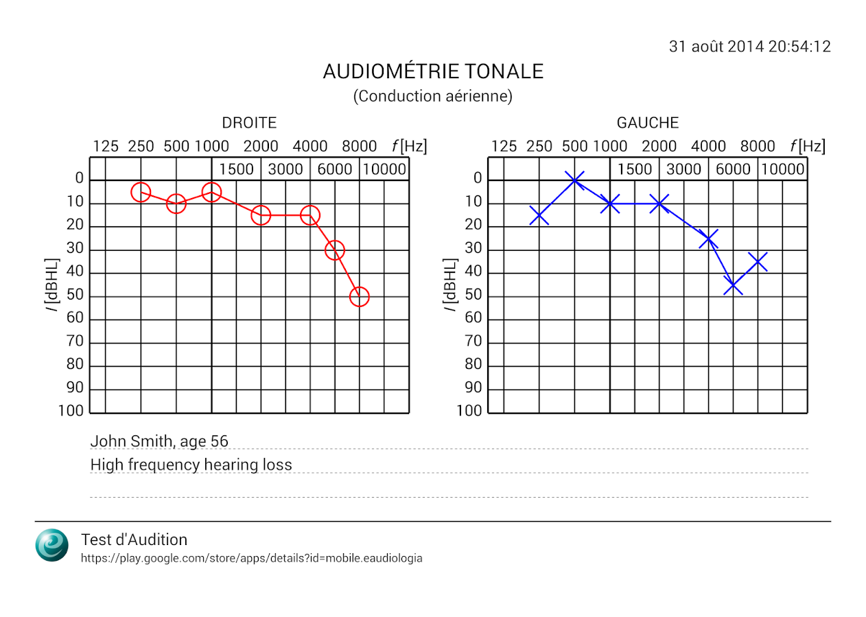   Test d'Audition – Capture d'écran 