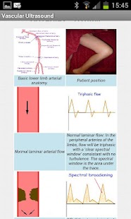 Vascular Ultrasound Screenshots 6