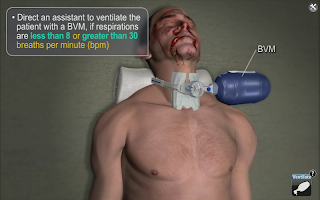 Captura de pantalla de Medrills: Cricothyroidotomy APK #11