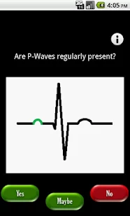 AliveCor Mobile ECG