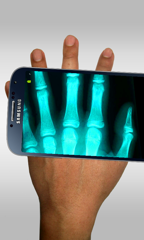 Android application Xray Scanner Prank screenshort