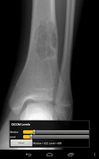 Image Viewer rapide - screenshot thumbnail