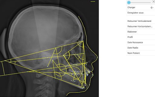 【免費醫療App】Analyses Céphalométriques-APP點子
