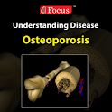 Osteoporosis logo