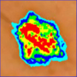 Skin Mole Analysis logo
