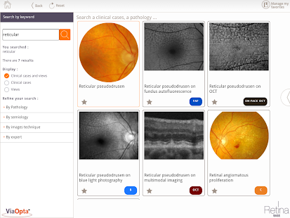 Retina Base Screen 3