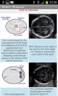 Obstetric Ultrasound Screenshots 3