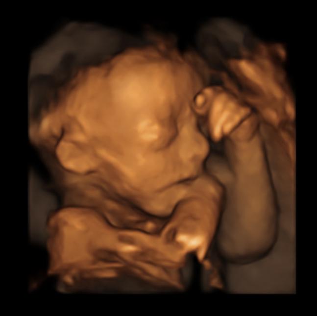 Pregnancy by week Screen 2