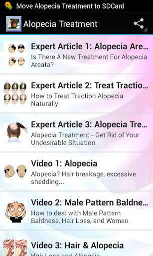Alopecia Treatment Guide