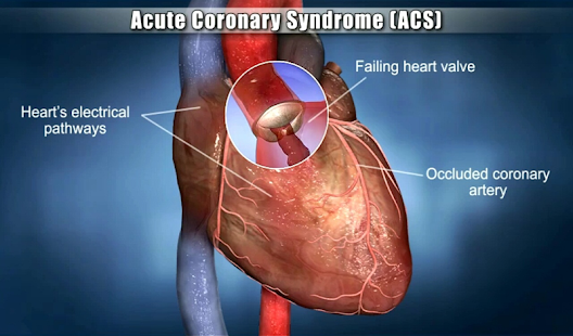 Free Download Medrills: Cardiac Emergencies APK for PC