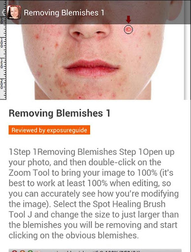 Removing Blemishes Image