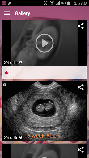 【免費醫療App】Pregnancy-APP點子