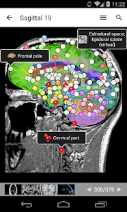 IMAIOS e-Anatomy