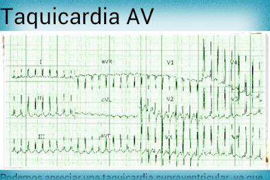 Electrocardiograma PRO poster 13