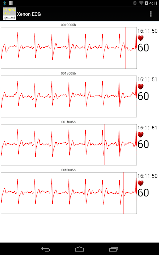 Xenon ECG 4 channels