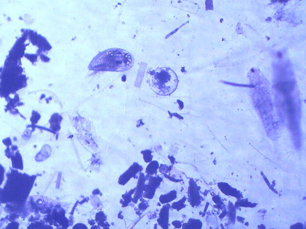 Ostracod and egg