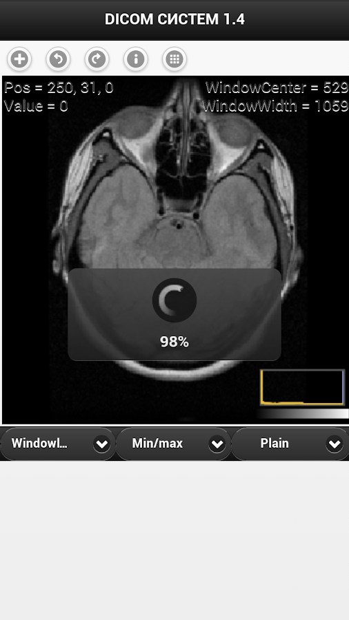 Syngo Fastview For Mac Download
