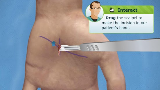 How to download Carpal Tunnel Surgery patch 1.0 apk for android