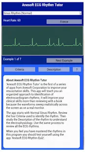 ECG Rhythm Tutor