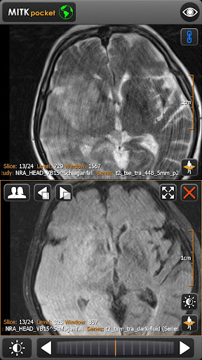 【免費醫療App】MITK pocket - DICOM Viewer-APP點子