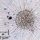 Heliozoan  (Sun Animalcule)