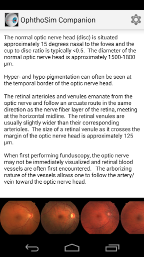 OphthoSim Companion Demo