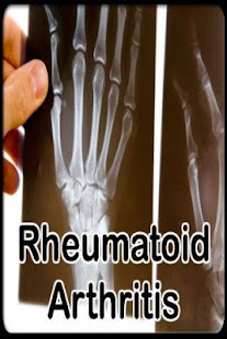 Rheumatoid Arthritis Treatment Screenshots 0