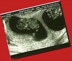 Baby 3 @ 9.5 weeks