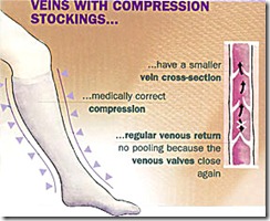 compression_stocking