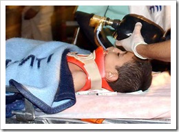 gaza-attack-wounded-child-2-2