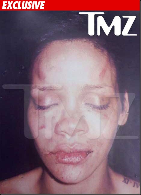 Popstar rihanna photo after beaten by Chris Brown TMZ