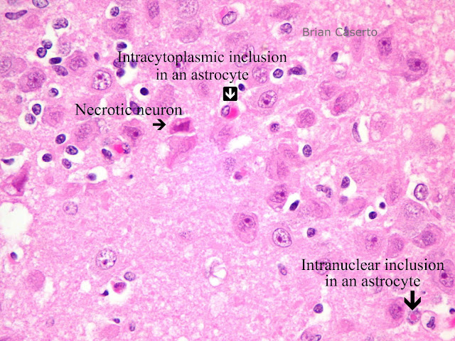 Introduction to CDV | virologycdv