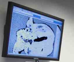 A virtual slice through the skull of Australopithecus sediba reveals a remnant of brain.