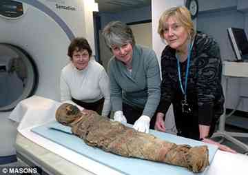 Ancient mystery: experts at Addenbroke's hospital discovered the mummified child sustained serious injuries.