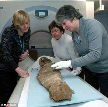 Broken bones: X-rays showed that both the child's skull and collarbone were fractured.