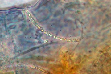 chemolithoautotrophic