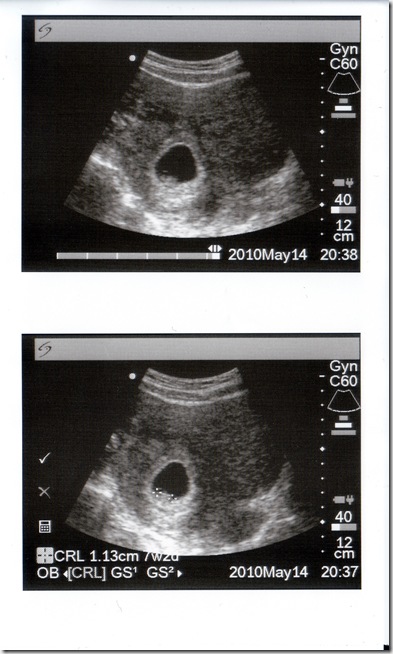 20100514 20100514
