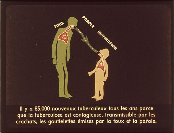 Films fixes et publicités de quartier (educational filmstrips) sur www.filmfix.fr : Conseils aux tuberculeux
